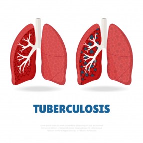 theme-world-tuberculosis-day_115560-141